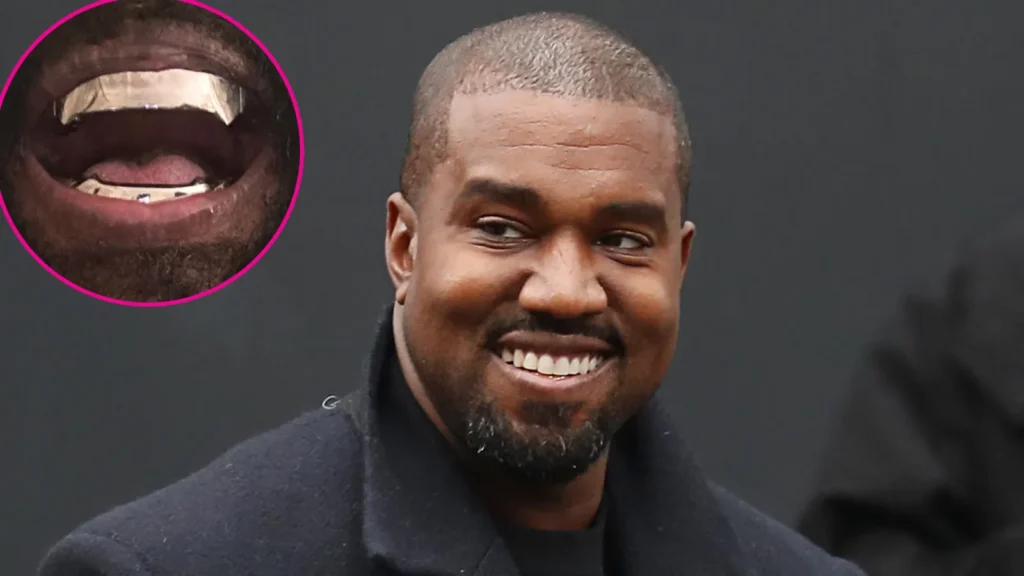 Kanye-West-Shows-Off-850000-Titanium-Grill.webp