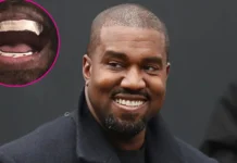 Kanye West’s teeth now titanium dentures worth $850,000 Kanye-West-Shows-Off-850000-Titanium-Grill.webp